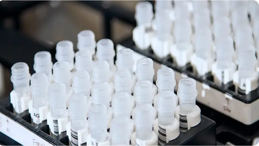control legionella laboratorio